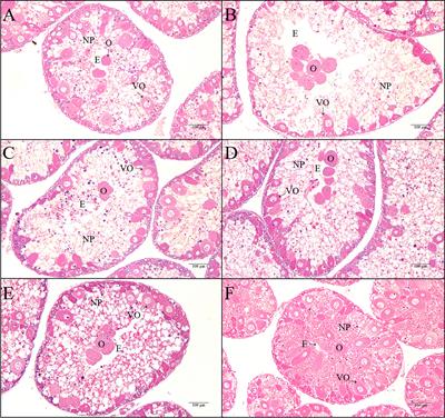 Effects of Dietary Lipid Sources on the Growth, Gonad Development, Fatty Acid Composition and Spawning Performance of Broodstock, and Early Larvae Quality of Sea Urchin (Strongylocentrotus intermedius)